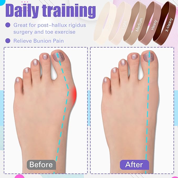 Set of 5 Toe Stretcher Band Separator Spacer Bunion Correction Hallux Valgus Alignment Foot Stretcher Straightener Resistance Loop Yoga Exercise Foot Care with Carry Bag(Coffee)