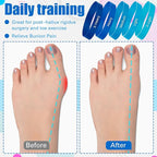 Set of 5 Toe Stretcher Band Separator Spacer Bunion Correction Hallux Valgus Alignment Foot Stretcher Straightener Resistance Loop Yoga Exercise Foot Care with Carry Bag(Blue)