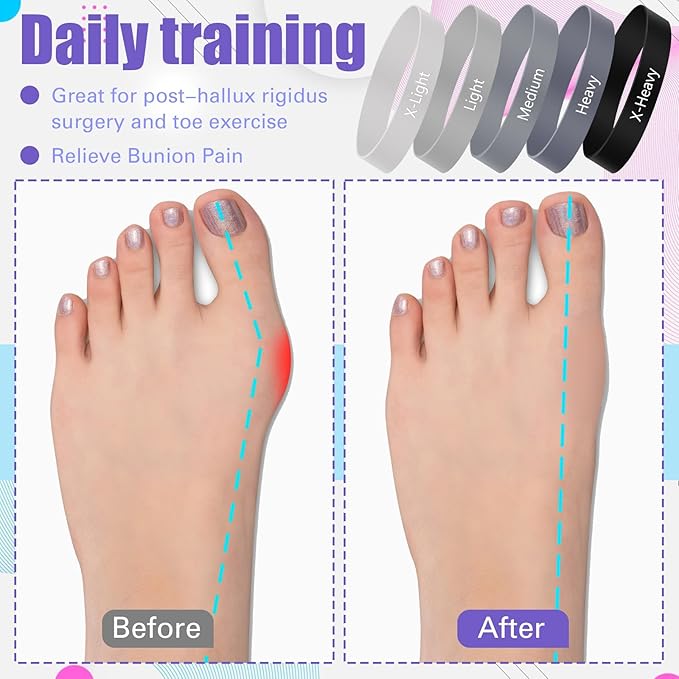 Set of 5 Toe Stretcher Band Separator Spacer Bunion Correction Hallux Valgus Alignment Foot Stretcher Straightener Resistance Loop Yoga Exercise Foot Care with Carry Bag(Grey)
