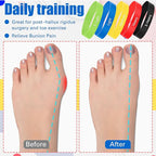Set of 5 Toe Stretcher Band Separator Spacer Bunion Correction Hallux Valgus Alignment Foot Stretcher Straightener Resistance Loop Yoga Exercise Foot Care with Carry Bag(Multicolor)