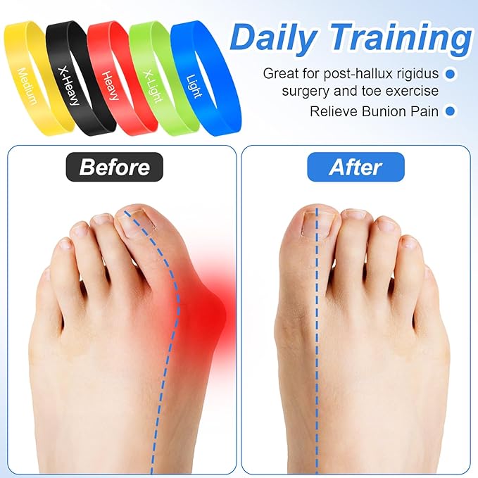 Sibba 5Pcs Toe Resistance Bands Toe Stretcher Bands for Bunion Correction Bunion Relief Toes Strength Foot Exercise Band for Hallux Valgus Yoga Daily Toes Training